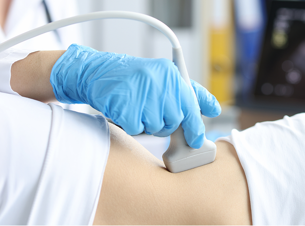 체외충격파 치료